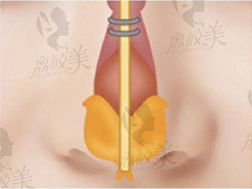 福州薛克墘黄金三角鼻综合价格23000元起