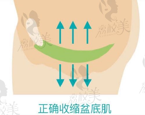 盆底肌修复能让下面变紧吗