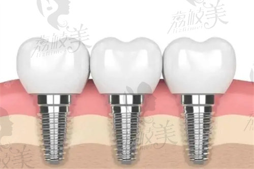 黔东南口腔医院收费贵吗