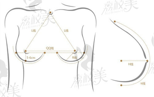 西安国医整形李高峰医生做乳房再造手术做的怎么样？