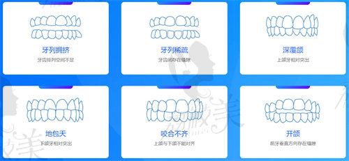 正雅隐形矫正和可丽尔哪个好