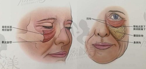 深圳脸部筋膜提升医院排名前十