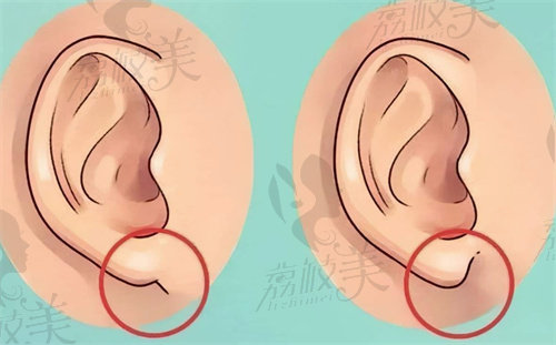 重庆松山（原宽仁）整形医院耳再造怎么样