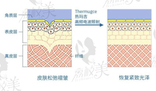 廣東熱瑪吉官網(wǎng)認(rèn)證機(jī)構(gòu)有哪些