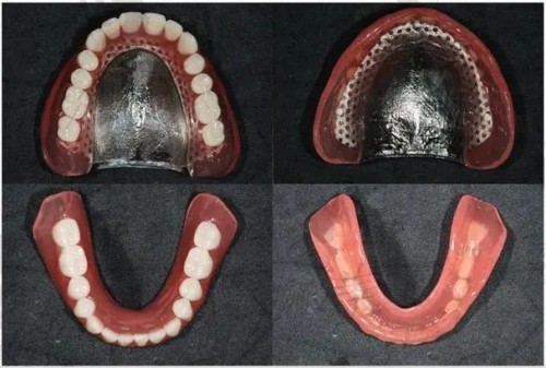 吸附性义齿是什么材料做的?