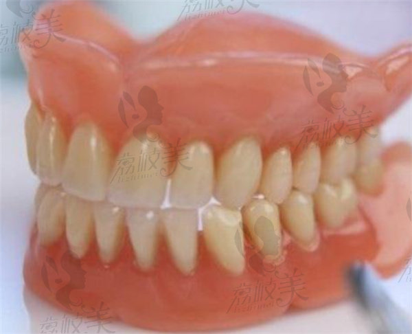 老人无牙牙床萎缩吸附式假牙