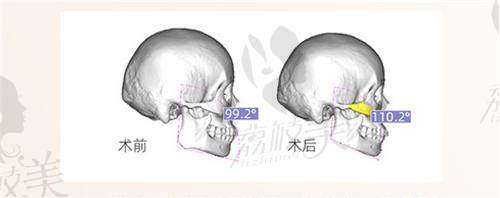 廣東改臉型醫(yī)生是誰(shuí)