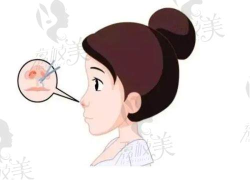 杭州连天美医疗美容医院做鼻子有哪些优势