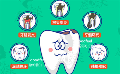 深圳格伦菲尔口腔医院根管治疗多少钱