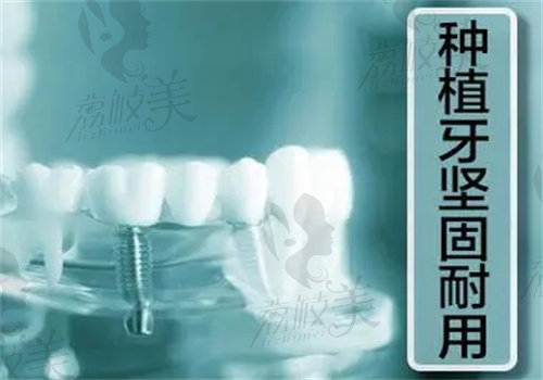 韩国种植牙和德国种植牙的区别