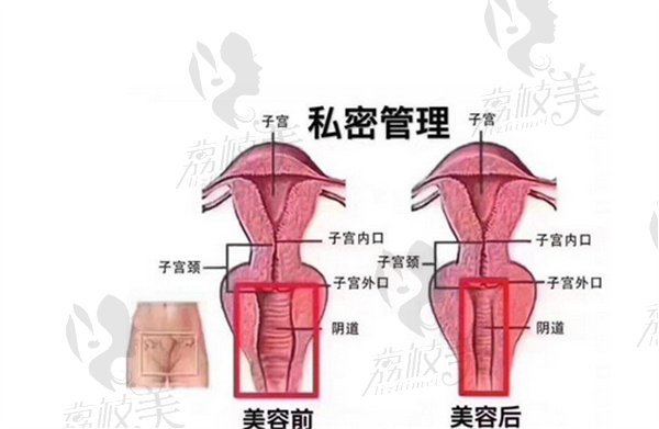 上海阴道紧缩医院哪家好