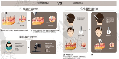 国内植发医院排名