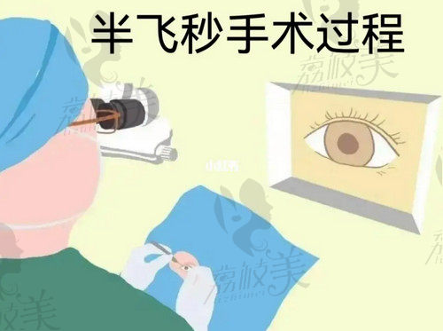 北京爱尔福康眼科医院近视眼手术口碑好