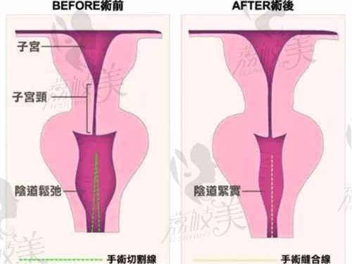 郑州第二中医院整形科朱静医生