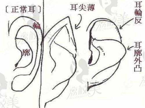 郑州第二中医院整形科仝晓医生