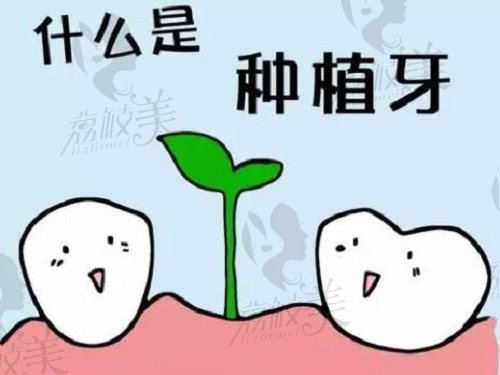 安阳种植牙多少钱一颗2023价格表