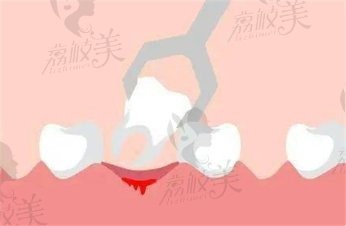 济南可恩口腔拔牙技术娴熟