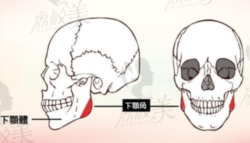 磨骨和削骨手术方式有哪些？