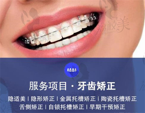 上海博义口腔牙齿矫正项目