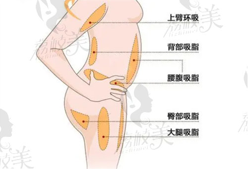 合肥抽脂手術醫(yī)院名單