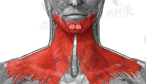 颈阔肌成形术术后注意事项