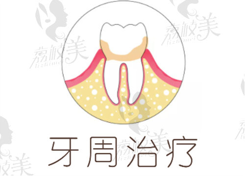 上海申洁口腔牙周治疗
