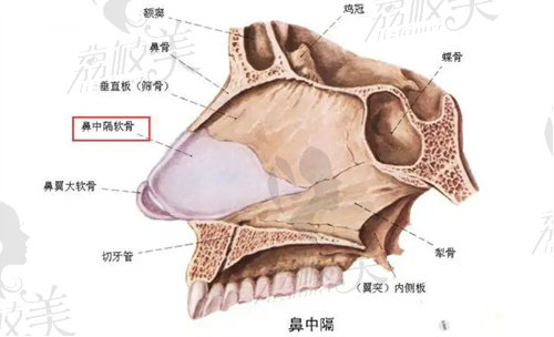 鼻中隔软骨隆鼻好不好