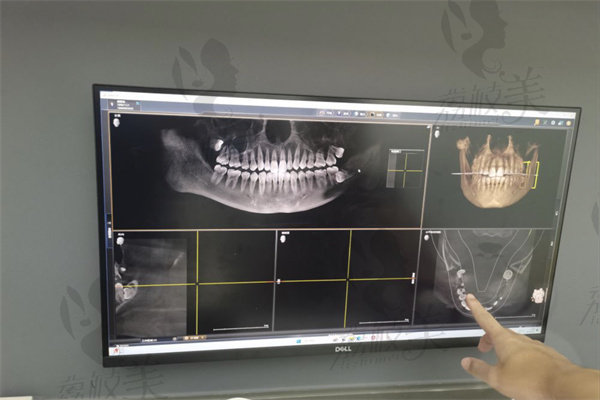 南京茀莱堡口腔医院种牙怎么样