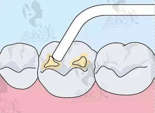 泉州柏德口腔医生技术怎么样啊