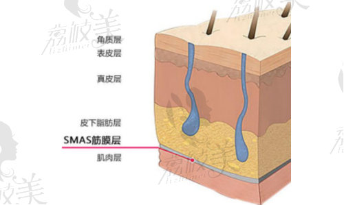 尖峰超声王多久可以看到成效