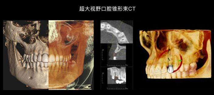 重庆拜博口腔矫正牙齿怎么样?数字化技术在牙齿正畸过程中的优势明显