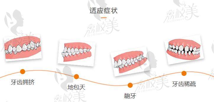 重庆拜博口腔矫正牙齿怎么样?医生技术实力和设备在线可改善各种症状