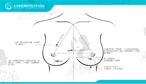 北京王驰隆胸技术怎么样