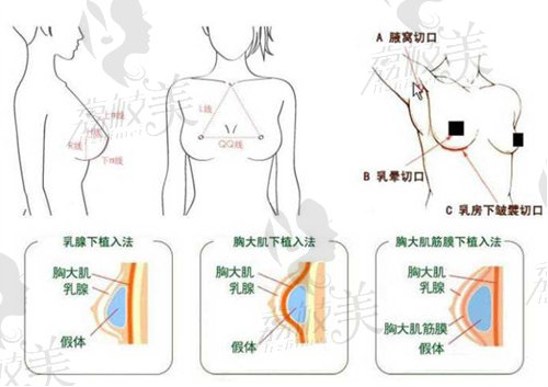 北京王馳擅長做啥手術(shù)