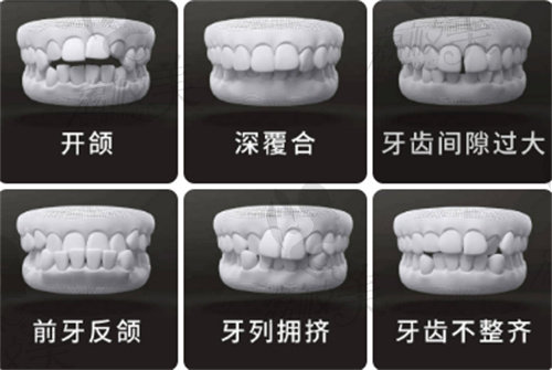 成都圣貝牙科牙齒矯正怎么樣