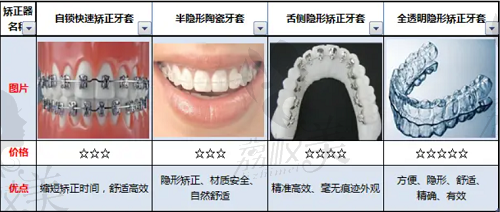 舌側(cè)矯正優(yōu)勢有哪些