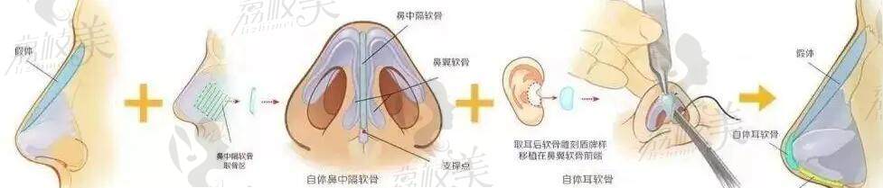 韩国整容技术比我国好吗