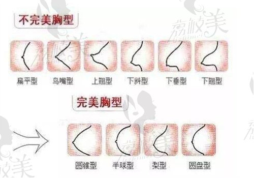 李高峰使用內(nèi)窺鏡下生物補(bǔ)片技術(shù)