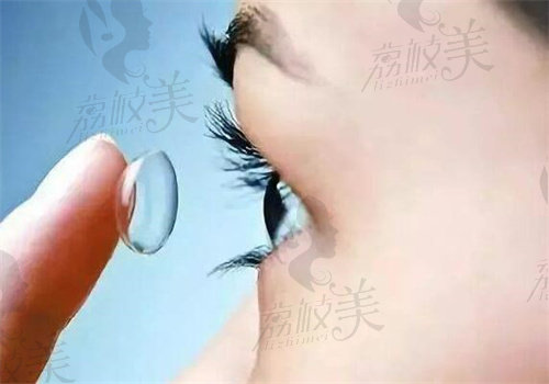 上海爱尔眼科角膜塑形镜价格