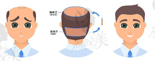 雷惠斌医生现在在成都米兰柏羽就职