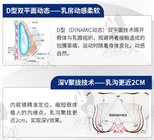 唐志荣隆胸口碑怎么样