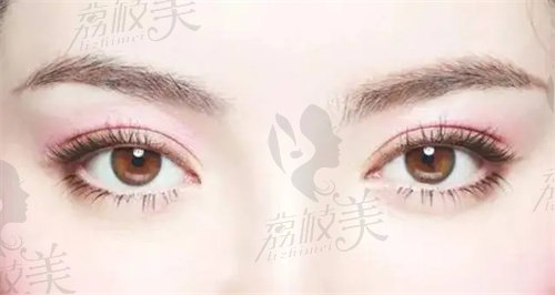 重庆当代肖文明做双眼皮做的好吗