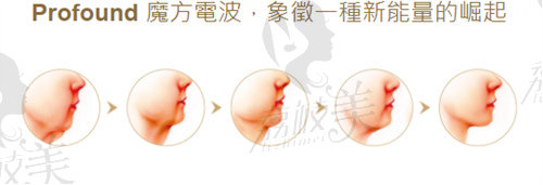 电波拉皮后个人经历