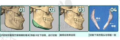 東籬葉斌磨骨怎么樣