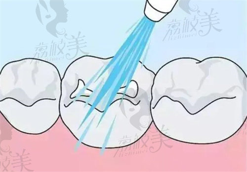 绵阳牙科医院看牙技术好