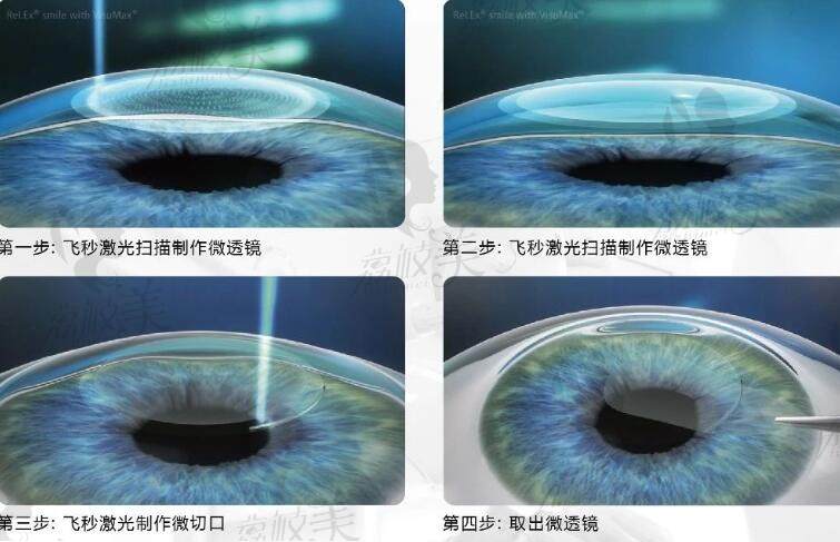 北京同仁医院眼科预约挂号