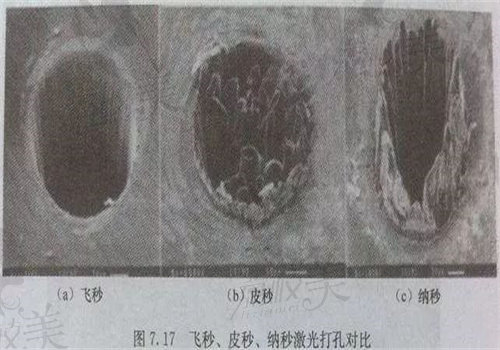 皮秒激光的作用