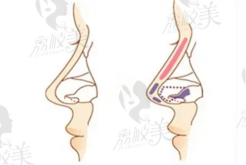 济南艺星做鼻子怎么样