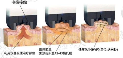 钻石超塑和即塑3d有什么区别