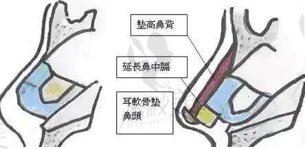 沈阳杏林整形隆鼻医生哪个好